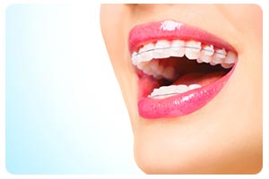 Ortodontia | Dentista Uberlândia